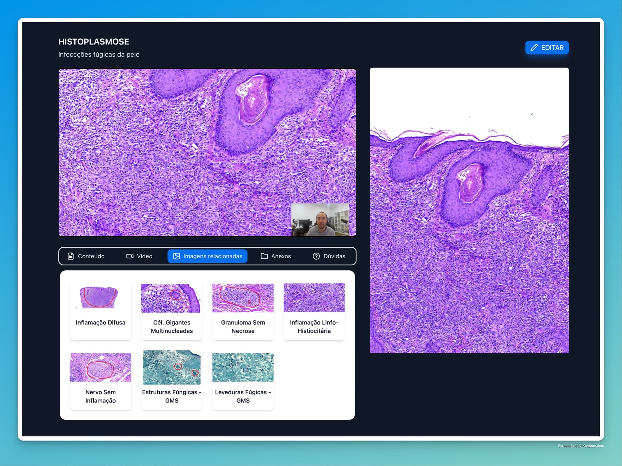 Interface do microscópio virtual Histoclass mostrando análise detalhada de lâmina histológica
